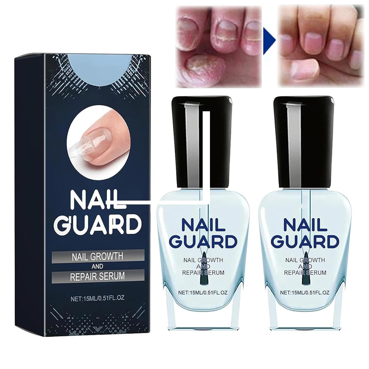 Onyxoguard Nail Growth and Repair Serum, Nail Growth Serum, Nail Serum For Growth And Strength, Thin Nails And Growth,Revitalize And Strengthen Your Nails (2 PCS), transparent